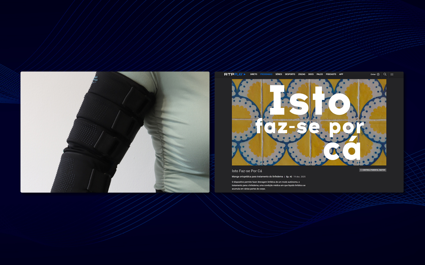 RDP Internacional highlights therapeutic innovation for lymphoedema treatment